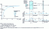 Figure 12 - FRF slot response function for a conventional camera (dashed line, example for a matrix camera)