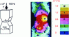 Figure 22 - Infrared vibrothermography of an unreinforced concrete specimen: the heat intensity on the thermogram localizes the mechanical damage to the material [49].