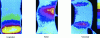 Figure 4 - Fracture mechanisms in simple compression on spruce test specimens cut in the three anisotropy directions: the location of plastic hinges preceding specimen failure can be clearly distinguished [24].