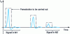 Figure 8 - Schematic diagram of the different time signals obtained at the 2 measurement points as a function of time.