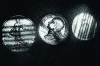 Figure 15 - Coins in motion during installation (doc. ISL)