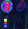 Figure 38 - Quantitative analysis of a double-exposure, double-reference interferogram of a composite subjected to impact (doc. ONERA-ISL-HOLO3)