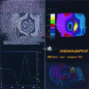 Figure 11 - Checking a composite using shearography. Thermal stress (doc. HOLO 3)