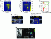 Figure 17 - Acousto-optical images with spectral
filter (a) before intravenous injection of ICG and after (b). Correlation
with an ultrasound image (c), showing marker uptake in the liver,
also correlated with a low-resolution near-infrared fluorescence image
(d). (Credit Optica Publishing Group)