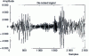 Figure 10 - Wiener filter-distorted signal