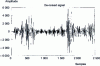 Figure 17 - Kalman-filtered destructured speech signal