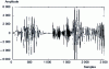 Figure 20 - Noiseless speech signal