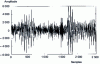 Figure 21 - Noisy speech signal (signal-to-noise ratio equal to 7.35 dB)