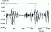 Figure 22 - Adaptive speech filtering (signal-to-noise ratio equal to 17.85 dB)