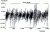 Figure 9 - Noisy speech signal