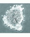 Figure 7 - Aggregation of melanoma cells on HPMC-coated polystyrene supports