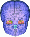 Figure 6 - MEF from the head of a three-year-old child