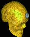 Figure 7 - Numerical impact of an elastomer bullet in the frontal zone of the human head