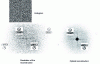 Figure 23 - Reconstruction of a coded hologram using the Direct Binary Search (DBS) algorithm