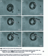 Figure 12 - Optical microscopy image of the wax-water-SiO2 system. Capsules obtained for a TEOS mass concentration of 5% relative to the continuous oil phase (polydimethylsiloxane-PDMS) of the double emulsion wax-water-oil(PDMS) [27] (doc.Wiley-VCH)