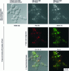 Figure 4 - Protein colocalization by optical microscopy and digital image processing