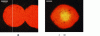 Figure 8 - (a) View of the surface of a plattnerite pellet after irradiation with a GaAs diode laser at a power density of 12 W/cm2, (b) view of the surface of a plattnerite pellet after irradiation with an Ar+ laser at a power density of 8 W/cm2.