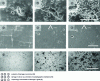 Figure 1 - Scanning electron and optical microscopy images of ultrasonic cavitation damage to the surface of various bulk materials