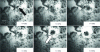 Figure 9 - Optical microscopy images showing the detachment of a biofilm in the vicinity of a microhole (black dot indicated by a black arrow) from which cavitation microbubbles originate in the form of a cloud (indicated by a white arrow) (after [32]).