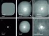Figure 11 - Transmission electron microscopy of multiple pores before (top row) and after (bottom row) deposition of Al2O3 coatings by ALD (reproduced with permission [75]. Copyright 2004, American Chemical Society).