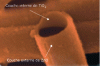 Figure 3 - SEM image of TiO2/ZnO core-shell nanotubes: inner TiO2 and outer ZnO layer are pointed by arrow (reproduced with permission [24]. Copyright 2014, American Chemical Society).