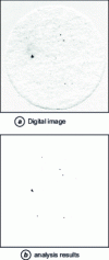 Figure 3 - Analysis of a digital image of a membrane