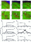 Figure 6 - Mass spectrometry images recorded on the surface of rat cerebellum sections illustrating the three operating modes of the liquid-tipped ion source, and mass spectra in positive modes. a, b, c: images recorded in HCBU, BA and BA+DE modes; superimpositions in three colors, stearic acid (red), palmitic acid (green), cholesterol (blue); d, e, f: enlargements of the three previous images; g, h, i: extracts of positive-mode mass spectra of the cholesterol zone, in HCBU, BA and BA+DE modes; j, k, l: extracts of positive-mode mass spectra of the vitamin E zone, in HCBU, BA and BA+DE modes [1] [2] [8].