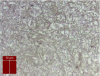 Figure 4 - Metallurgical structure at 100 µm depth of a carbonitrided 27CrMo4 (optical micrograph after 4% Nital etching).