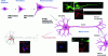 Figure 5 - Diagram of the different stages of neurodevelopment and death by neurodegeneration: application to the SH-SY5Y model. The development of a progenitor cell into a mature neuron involves several stages that can be modeled in the SH-SY5Y cell line and studied using fluorescence microscopy. The toxicity of environmental pollutants can be studied at these different stages, using two types of analysis: (i) morphological analyses such as mitochondrial morphology (Mitotracker), dendritic (MAP-2) and axonal (NF-L) complexity, and synaptogenesis at pre-synaptic (SV2) and post-synaptic (PSD95) levels, and (ii) functional analyses such as mitochondrial trafficking (Mitotracker) and mitochondrial ROS release (MitoSOX) (photographs Dr Sana Al Awadah; INSERM UMRS 1124). 