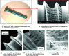 Figure 16 - Ultrafast laser surface functionalisation for cells repellence on
the surface of bone screws [18]