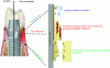 Figure 19 - Schematic of a dental implant in its implantation environment. Three
distinct regions are identified: upper mouth/gum interface region,
where bacteria tend to accumulate and proliferate; gum, where gingival
tissue adhesion play a key role to prevent bacteria from penetrating
into deeper region; and the lower region, the implant interfaces with
bones and bone forming cells