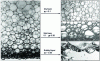 Figure 2 - Photographs of a liquid foam and bubble rearrangements according to liquid volume fraction [18].