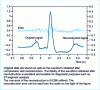 Figure 2 - Associated Hermite wavelet compression algorithm applied to an ECG wave taken from the MIT-BIH Arrhythmia database, record 105