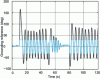 Figure 11 - Case without anti-windup – Evolution of saturated and unsaturated outputs of the travel PID controller