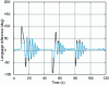 Figure 13 - Case with anti-windup – Evolution of saturated and unsaturated outputs of the travel PID controller