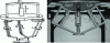 Figure 10 - Schematic view and prototype of the PAMINSA robot [53].