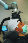 Figure 18 - The Axilum Robotics "Cobot" robot positions a transcranial magnetic stimulation probe in contact with the patient's head. The interaction force is regulated to 200 g using an FSR sensor located at the interface between the coil and the patient's skull (image courtesy of Axilum Robotics [R. Ginhoux]).