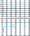 Figure 32 - Average profile in the ROI (top) and its numerical derivative (bottom) – Transitions detected are marked by a green vertical line.