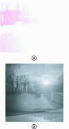 Figure 7 - Glare sensitivity of a CCD camera (a) and a CMOS camera (b)