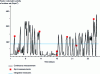 Figure 4 - Measurement techniques (source: ACS-Radon France Mesures)