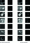 Figure 4 - Examples of grayscale images and their corresponding binary image: a) containing segmented defects only, and b) with over-segmentation.