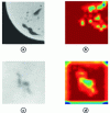 Figure 9 - Visual verification of the output of the last convolutional layer of the CT-Casting-Net: a) and c) input images with defects; b) and d) corresponding Grad-CAMs