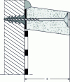 Figure 11 - Prefabricated projecting fascia