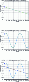 Figure 16 - Reallocated spectrogram of each of the two signals and of the mixture of the two signals