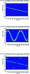 Figure 20 - Choï-Williams distribution of each of the two signals and of the mixture of the two signals