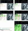 Figure 25 - Figure 24 continued  – Reconstructed image after 3-pass encoding and decoding of bit planes 1 to 11 (left to right and top to bottom) ([5] 122-134 and [2] figure 1.30 p. 62)