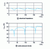 Figure 35 - Responses from a loudspeaker loaded with a quarter-wave column