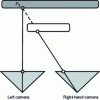 Figure 2 - Explanatory diagram of the occlusion
defect