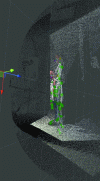 Figure 4 - Skeletons out of alignment