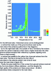 Figure 26 - Distance/speed diagram in MFR mode